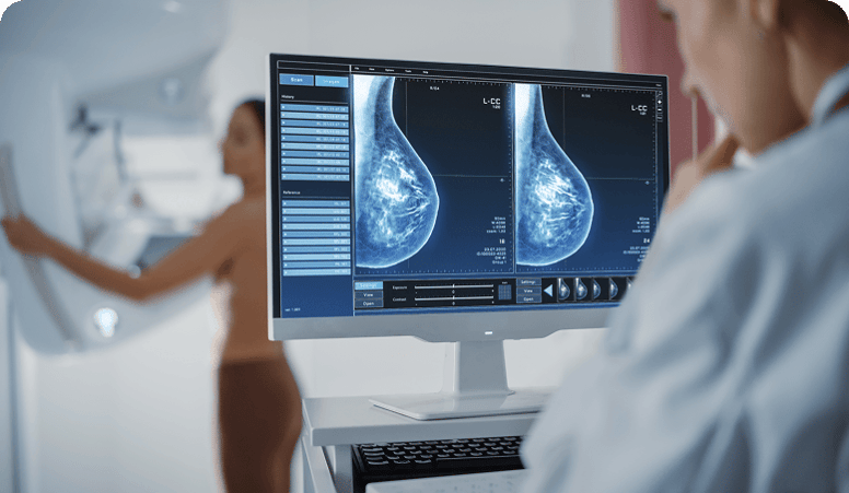 prevencion-cancer-de-mama-paquete-prevencion